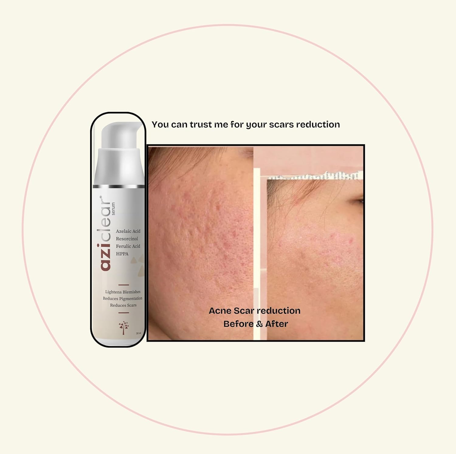 Aziclear Serum – Lightens Blemishes, Reduces Pigmentation and Scars | 30ml