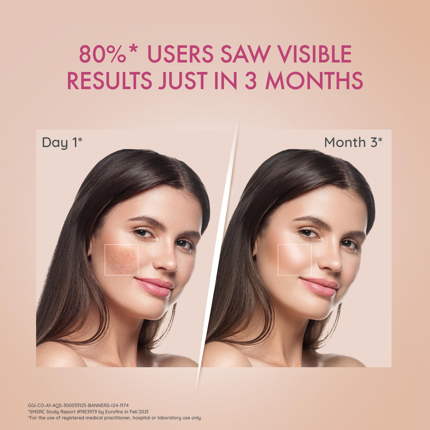 Depiwhite Dr Reddy's Advanced Cream for Bright & Even-toned Skin|Anti-Pigmentation| Removes Dark Spots|Glow Boost- Visible Brightness in 2 weeks|Kojic Acid Vitamin C|Dermatologist Recommended|15 ml