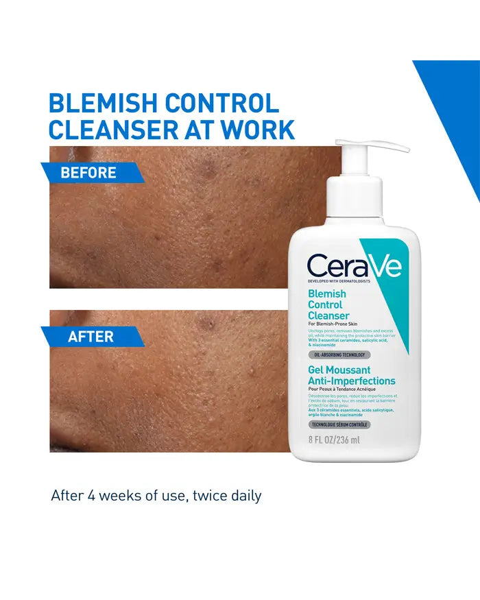 Cerave Blemish Control Cleanser With 2% Salicylic acid, 236 ml